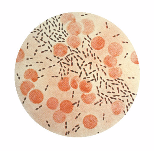 an image of the Penicillin-resistant Streptococcus pneumoniae bacteria in a lab